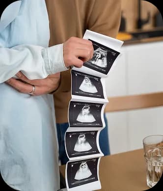 خدمات التشخيص والسونار